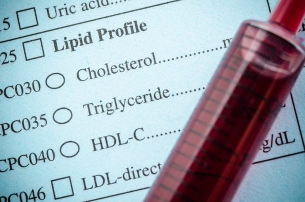 Lab report showing cholesterol